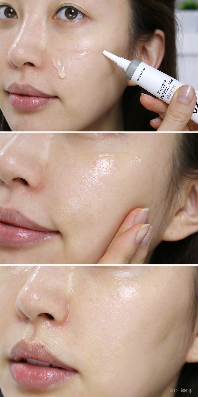 집에서 하는 아쿠아필 디바이스 ☆ 엔시트론 아쿠아바이탈케어 : 네이버 블로그