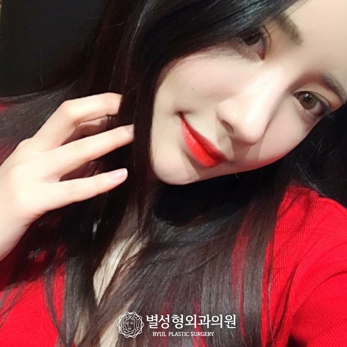  안검하수눈매교정 실천을 통해서