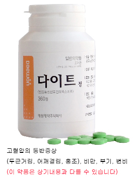  조현병 운동이 필요한가요?