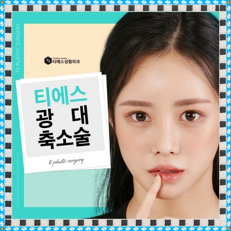 광대축소술 좋은 대안을 얻으려면