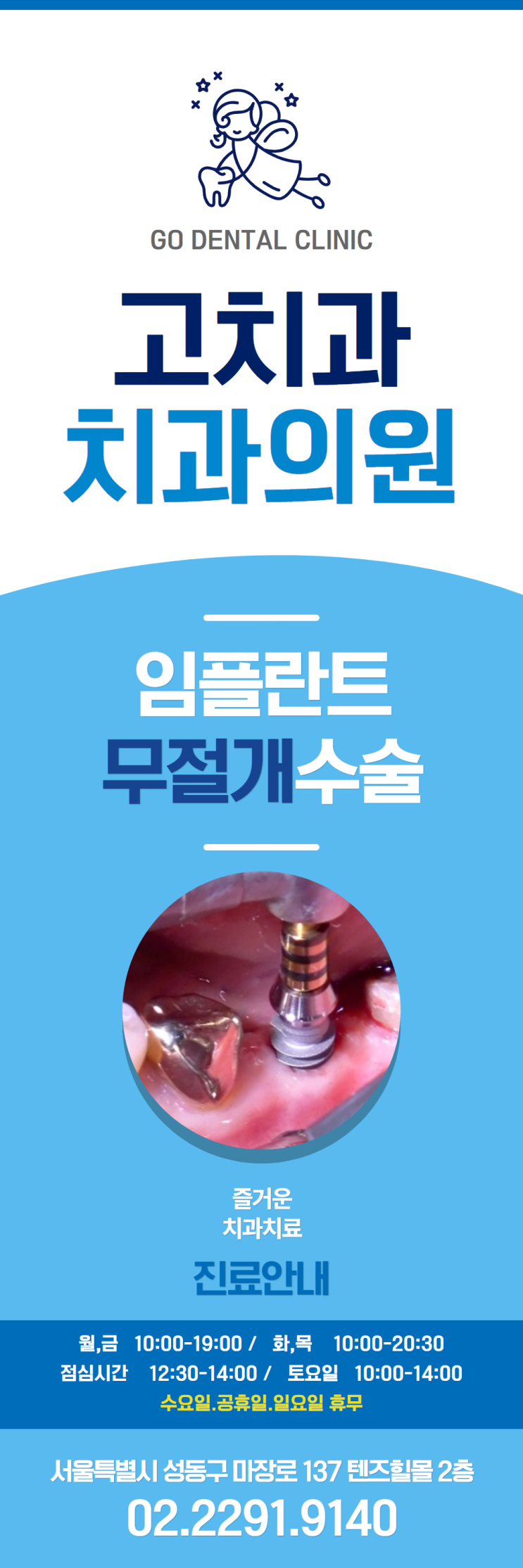  무절개 임플란트 술식 최적화 !