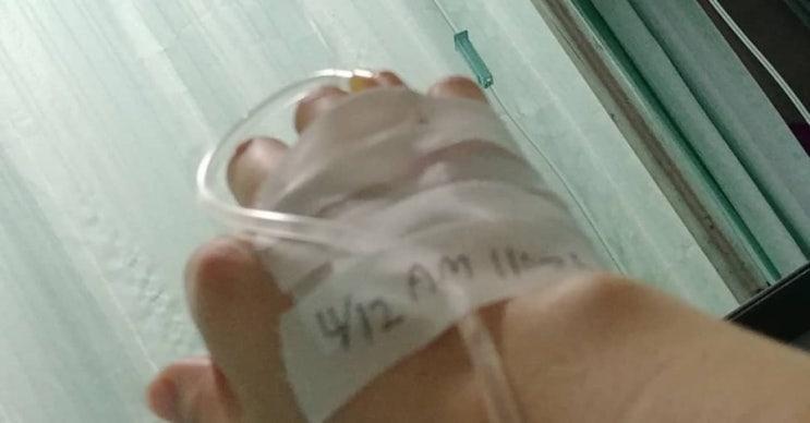  A형간염 입원기 급성간염 앓다.