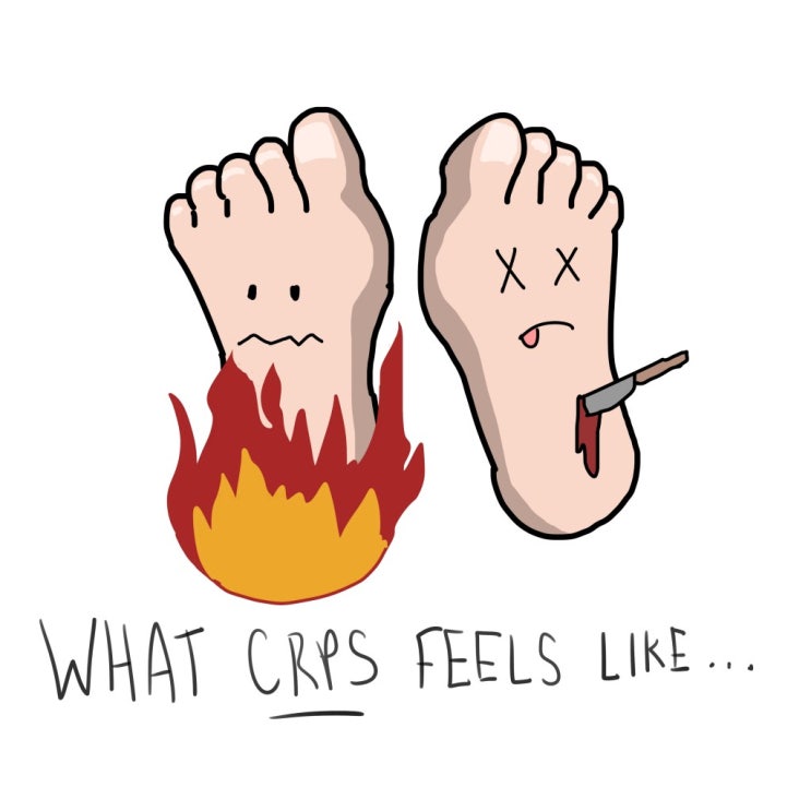  복합부위통증증후군 (complex regional pain syndrome, CRPS)