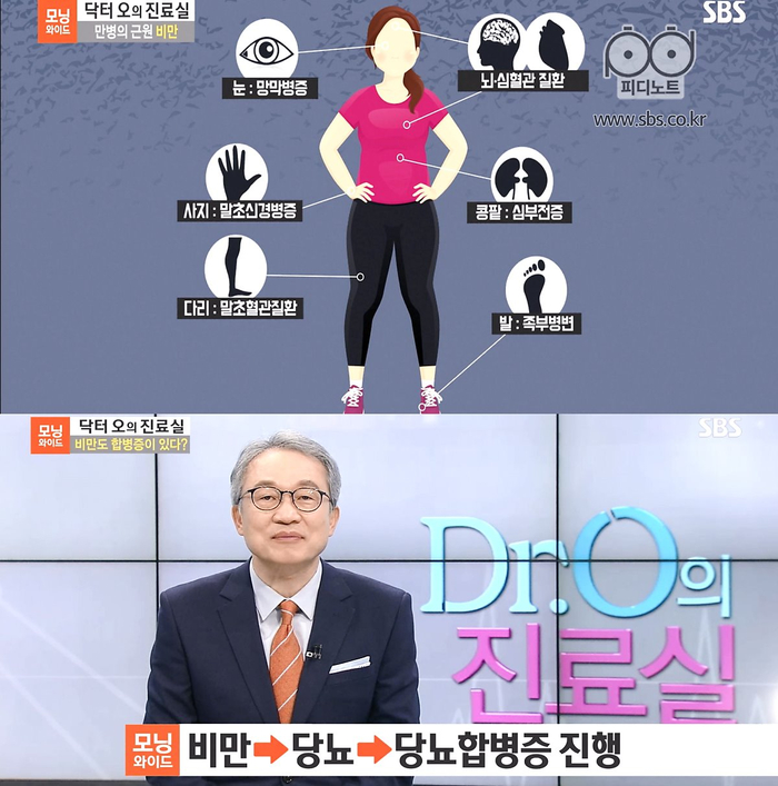 SBS 모닝와이드3주 PD노트/ 쉽게 살찌는 체질의 비만예방법!!