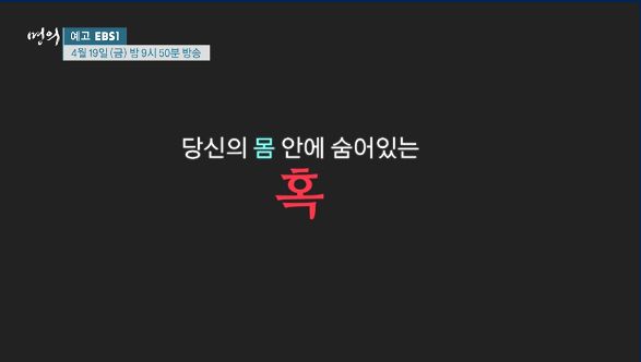  EBS명의 자궁의혹 암일까? 경희대의대 산부인과전문의 기경도 교수