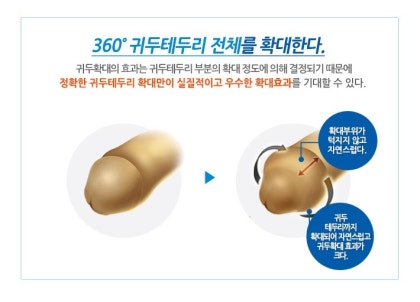 귀두크기 역시도 확대가 가능합니다 : 네이버 블로그 귀두크기 역시도 확대가 가능합니다 : 네이버 블로그