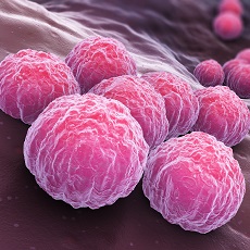  [동탄 비뇨기과] 클라미디아(Chlamydia) 진단과 치료, 후유증
