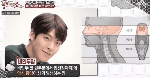  구본임 사망 비인두암은 무엇인가