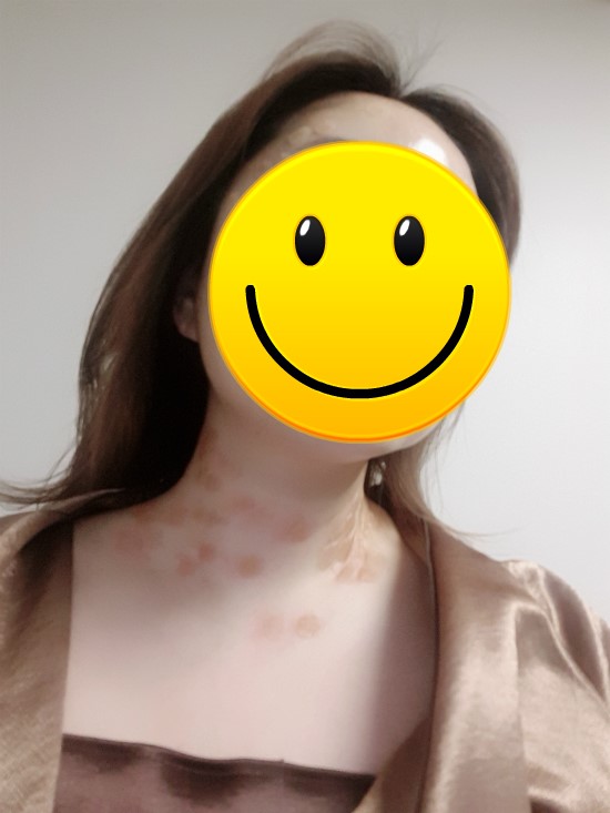 제목 : 예뻐지는건 너무 힘들어! ( 짱떡볶이, 생활의달인떡볶이, 목 레이져, 마법의 돌체라떼, 청송농부 감귤쥬스, 바디핏앰플, 스타벅스콜드컵, 갈맷길돼지국밥 ... )