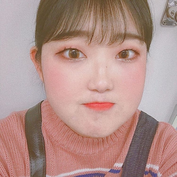 최준희 루푸스병? 최준희 루푸스병?