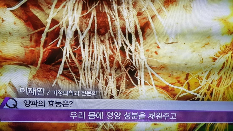  텔렌트 김영호 육종암 천기누설 샬롯 미니 양파의 항암 효능