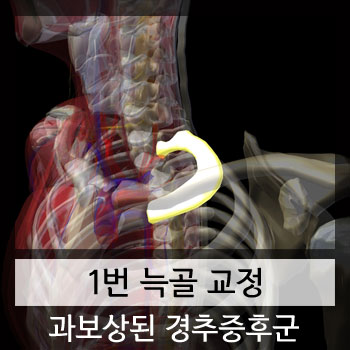  카이로프랙틱 도수치료 교육[1번 늑골교정]