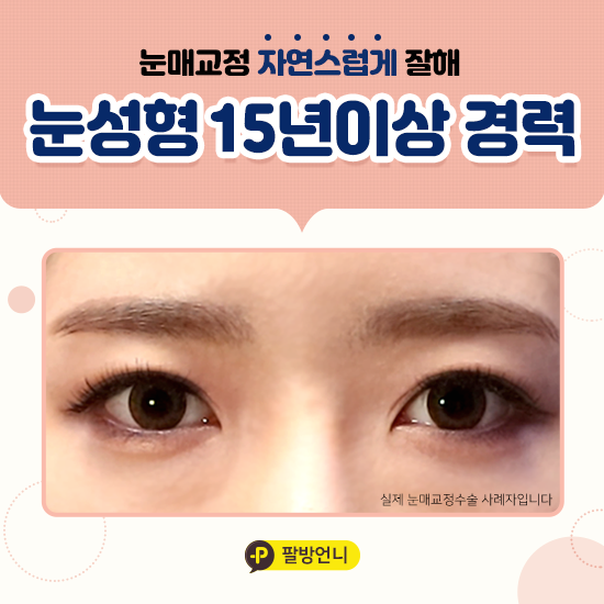  안검하수 증상 설마 내 얘기?