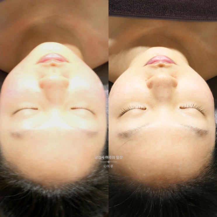  부천피부관리 결이고은 작은얼굴관리 받았어요