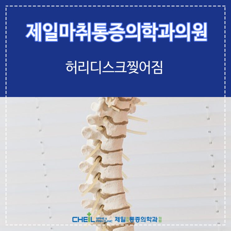  허리디스크찢어짐! 명지동통증의학과 어떤 치료로