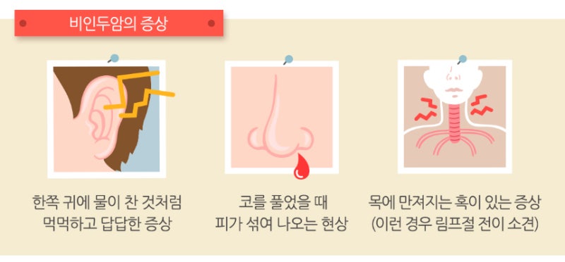 비인두암 초기증상, 인후이물감, 쉰목소리, 코막힘의 원인예방방법 11