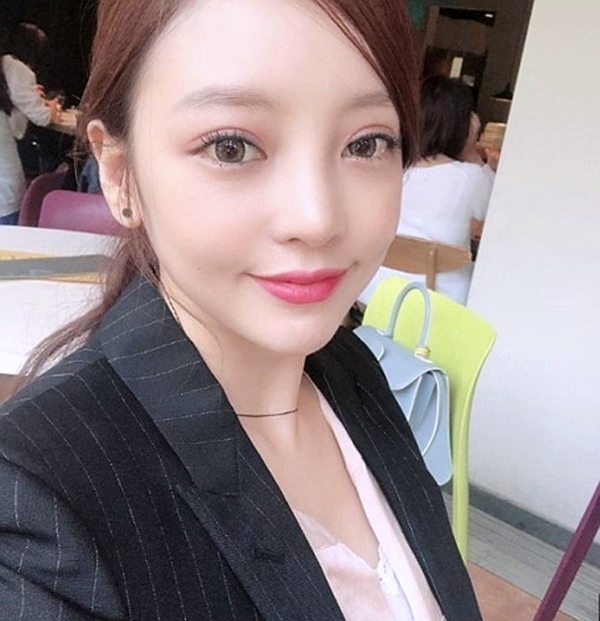  안검하수 수술받은 구하라