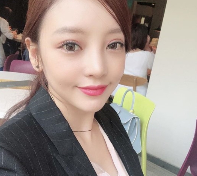  안검하수"수술 후 달라진 구하라 외모
