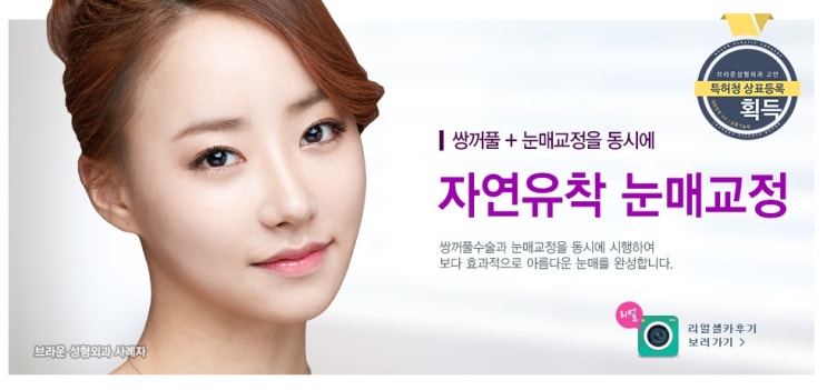  쌍커풀과 눈매교정을 동시에! 브라운 자연유착 눈매교정