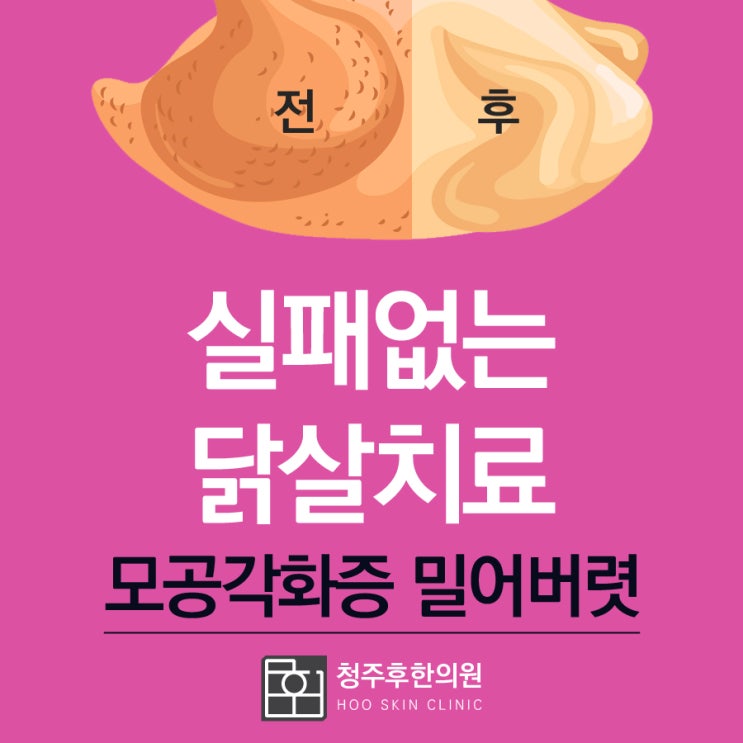  청주 모공각화증 한의원 전후살펴봐도 이곳밖에 없네