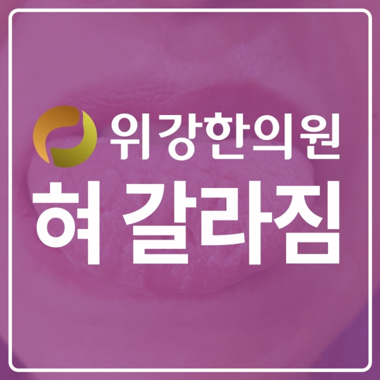  혀갈라짐 원인과 빠른 치료방법을 알려드리는 위강한의원
