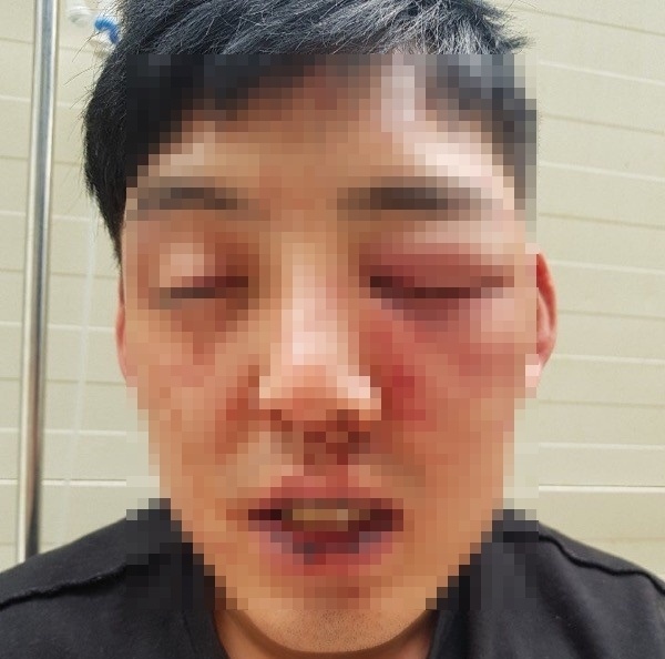  양호석, 차오름 폭행 의혹→차오름 심경 “가족 같던 사람, 서운해”