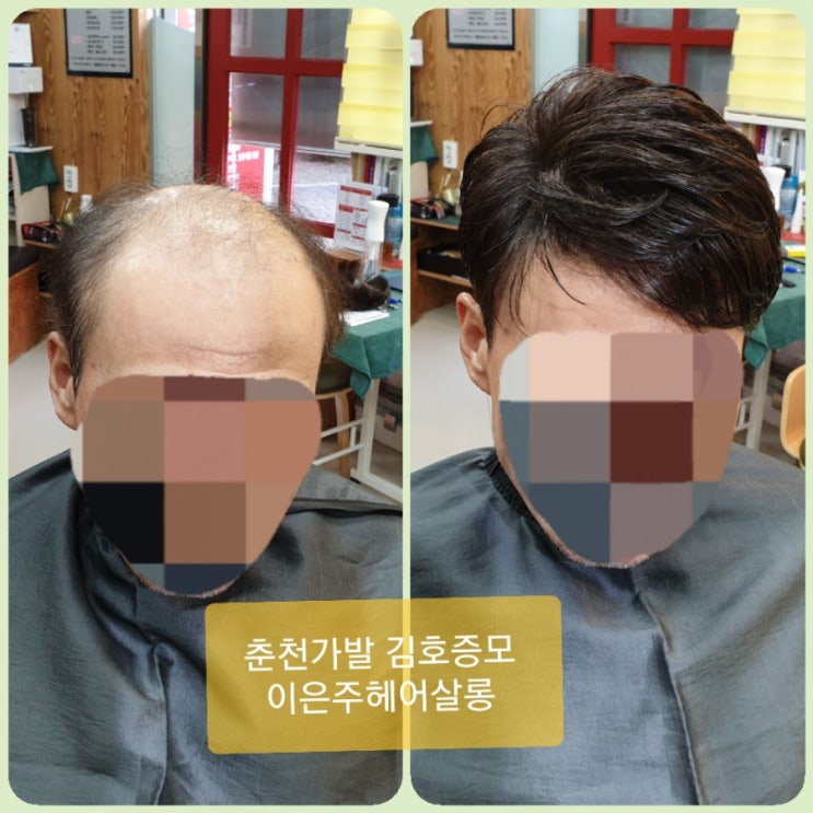  춘천가발 김호증모 탈모의 답을 찾아  춘천가발전문점 이은주헤어살롱에 왔습니다 가발관리로 자신감 뿜뿜~~~^^