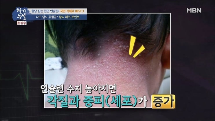  당뇨에 도움을 주는 천연 채소 best 3