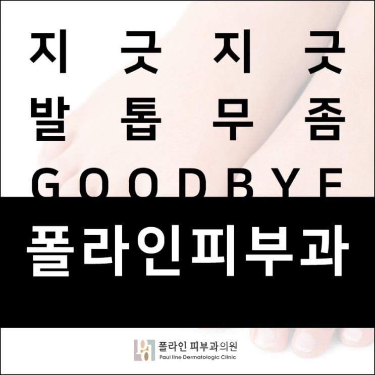  대전발톱무좀 자신감을 찾기