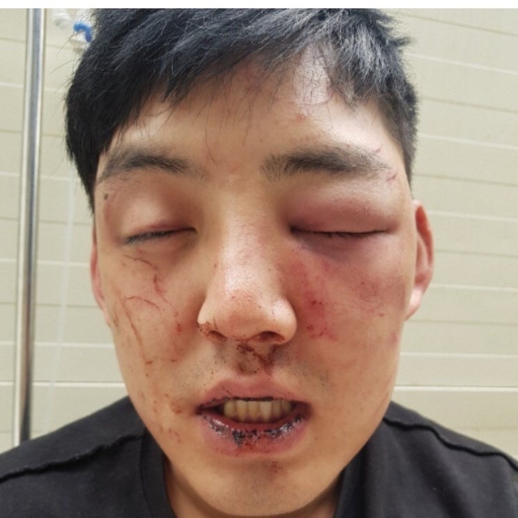  양호석 차오름 폭행 나이 인스타 알아보자.
