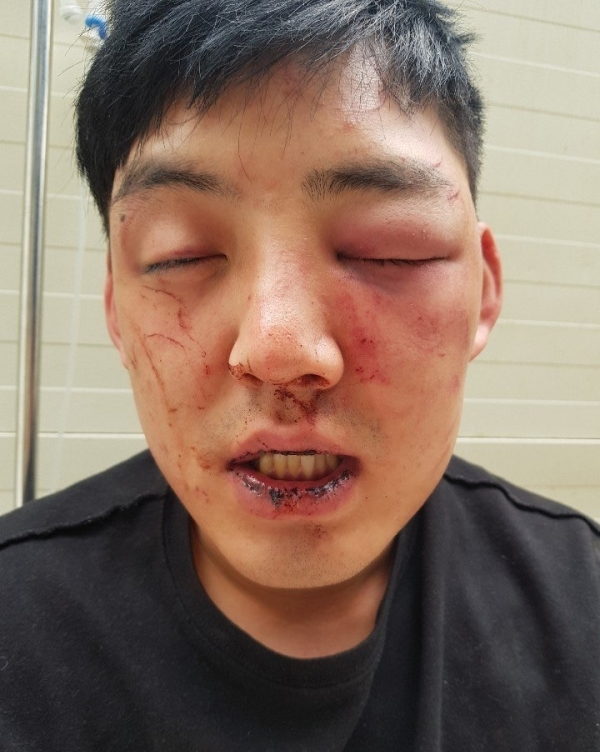 차오름 양호석에 폭행당했다 VS 양호석 시간 지나면 알게될 것 차오름 양호석에 폭행당했다 VS 양호석 시간 지나면 알게될 것