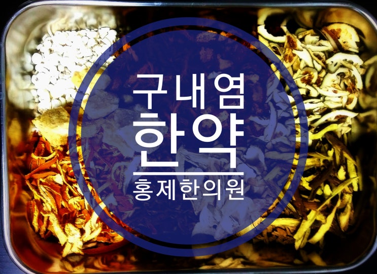  아프타성구내염 한의원에서는 어떻게 치료하나요?