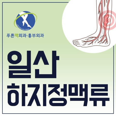 일산하지정맥류 대부분의 시간을 서서 보낸다면 위험
