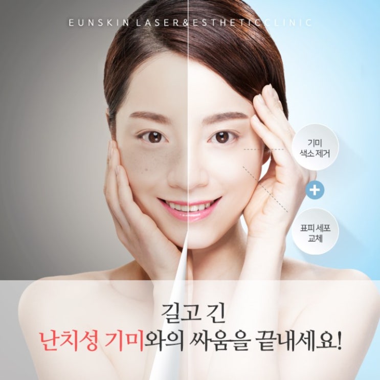  청담동피부과 기미치료는 과연 레이저토닝으로 효과가 있을까? ‘명의’ 청담동 은피부과는 여기!