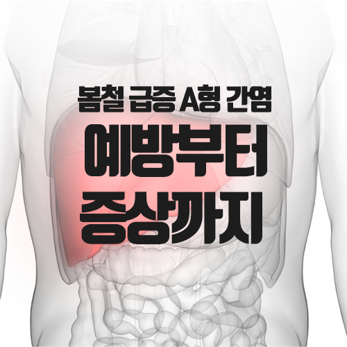  봄철 A형 간염 급증 :: 전국확산→심하면 사망