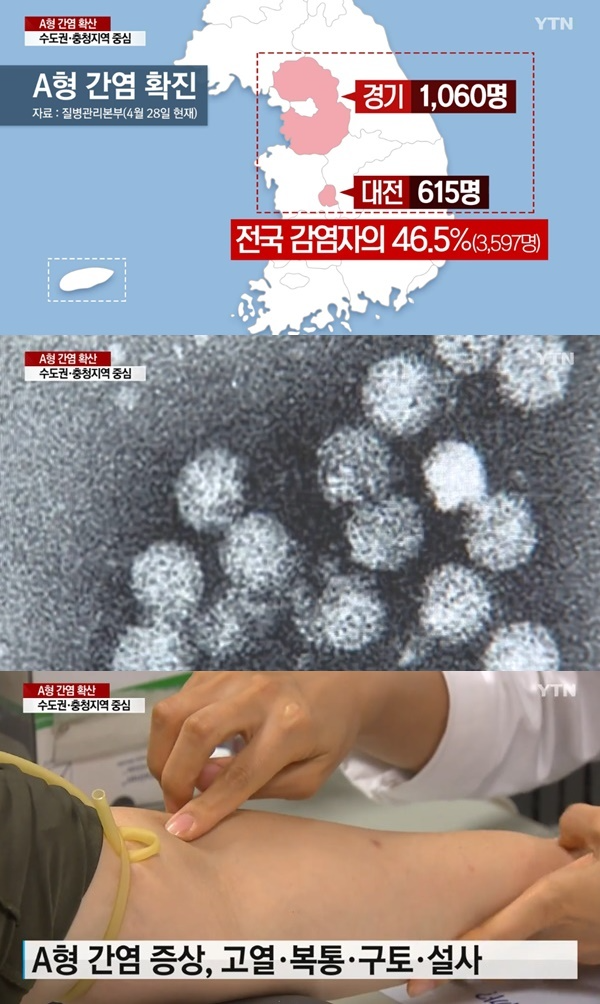  [비상] 'A형 간염' 서울, 경기 등 수도권 확산 중. 잠복기, 증상