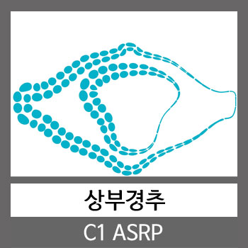상부경추 C1 ASRP