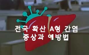  전국 확산 A형 간염 증상과 예방법