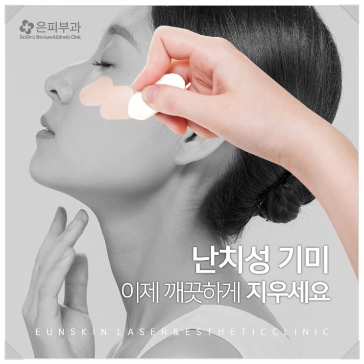  [명의] 청담동 피부과 난치성기미, 기미제거 ‘명의’ 은피부과 추천!