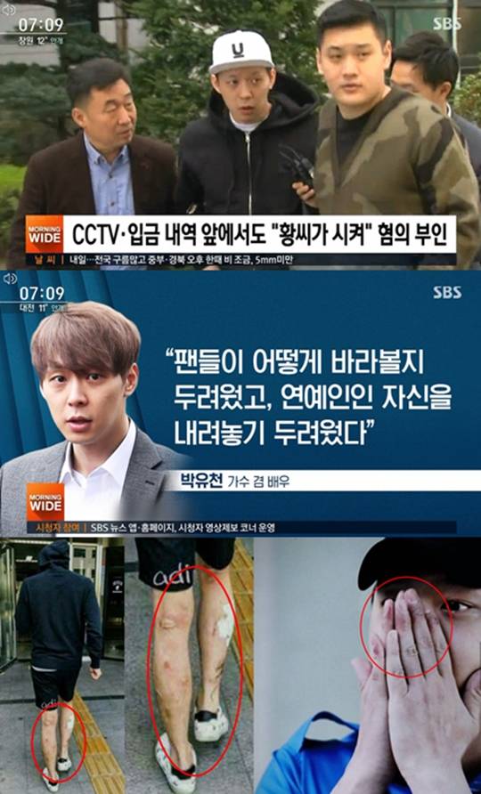  박유천 손,다리 마약부작용? '메스버그' 현상 의혹