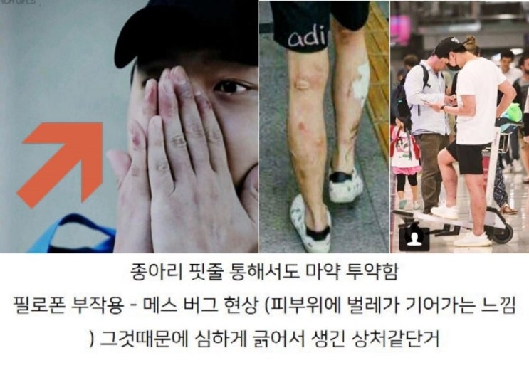  [이슈]박유천 다리, 이게 웬일...그때와 달라진 시선 / 메스버그 / 반여동왁싱