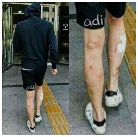  '마약 투약 인정' 박유천 다리 사진 오라인서 재조명 '매스버그 현상'