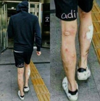  박유천 다리 음모론의 근거인 '메스버그(Meth Bug)'에 대해 알아볼께요.