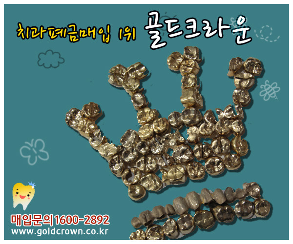  근로자의 날...치과폐금,폐금니 가격