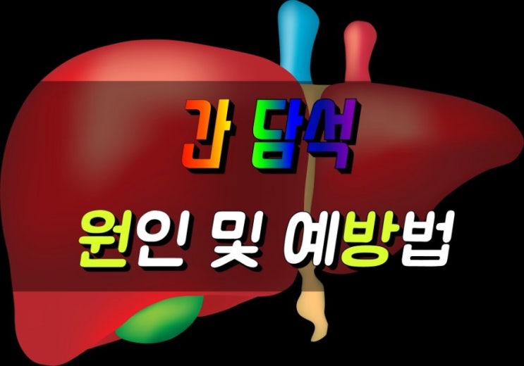  간과 담낭의 담석증상, 담석이 생기는 원인