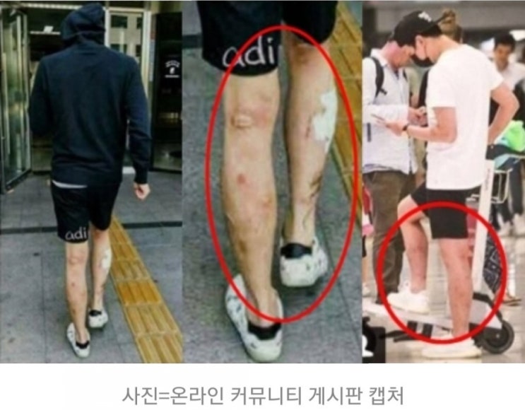  박유천 메스버그현상 마약 부작용? 언제부터