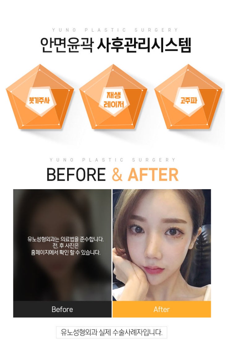  얼굴돌려깎기 어떻게 해야하죠?