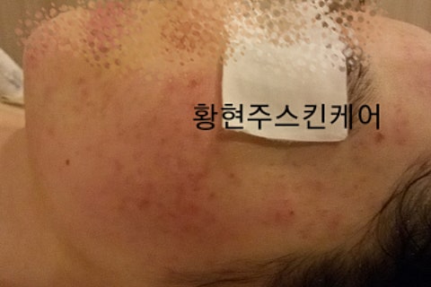 피디티 이미지