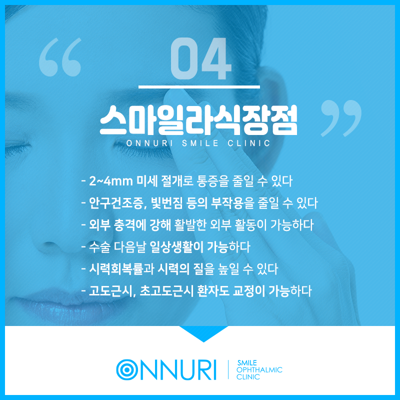 송현동안과에서 가르치는 라식나이