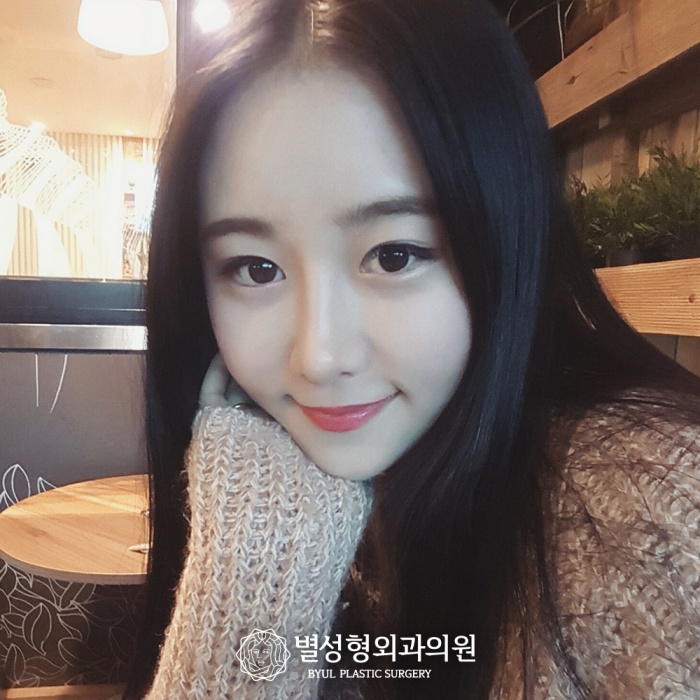  안검하수수술 성공적인 취업을위해서